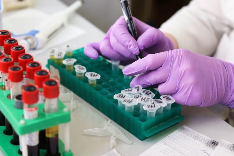 vitamin d deficiency tests